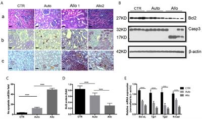 Protective Role of Kynurenine 3-Monooxygenase in Allograft Rejection and Tubular Injury in Kidney Transplantation